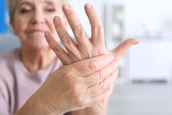Arthritis in hand
