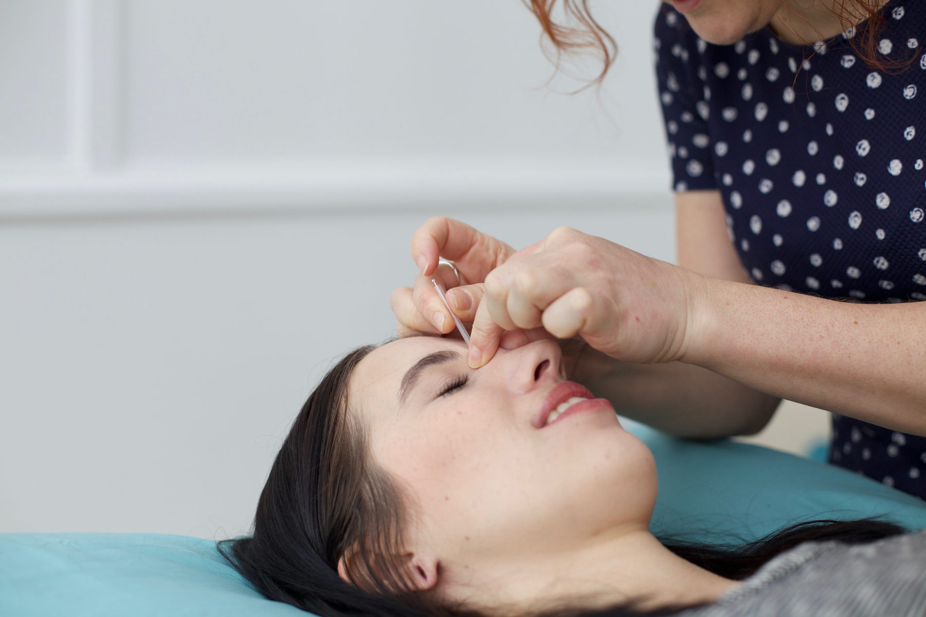 Acupuncture treatment Norwich