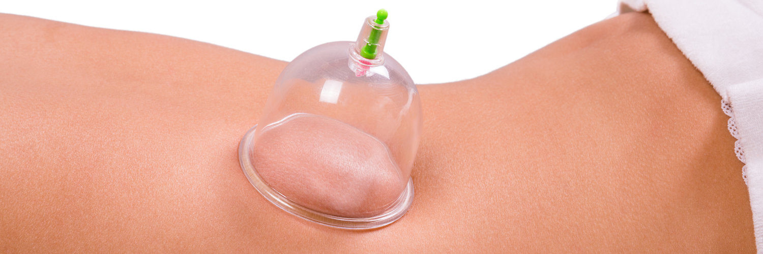 Cupping & Deep Tissue Massage