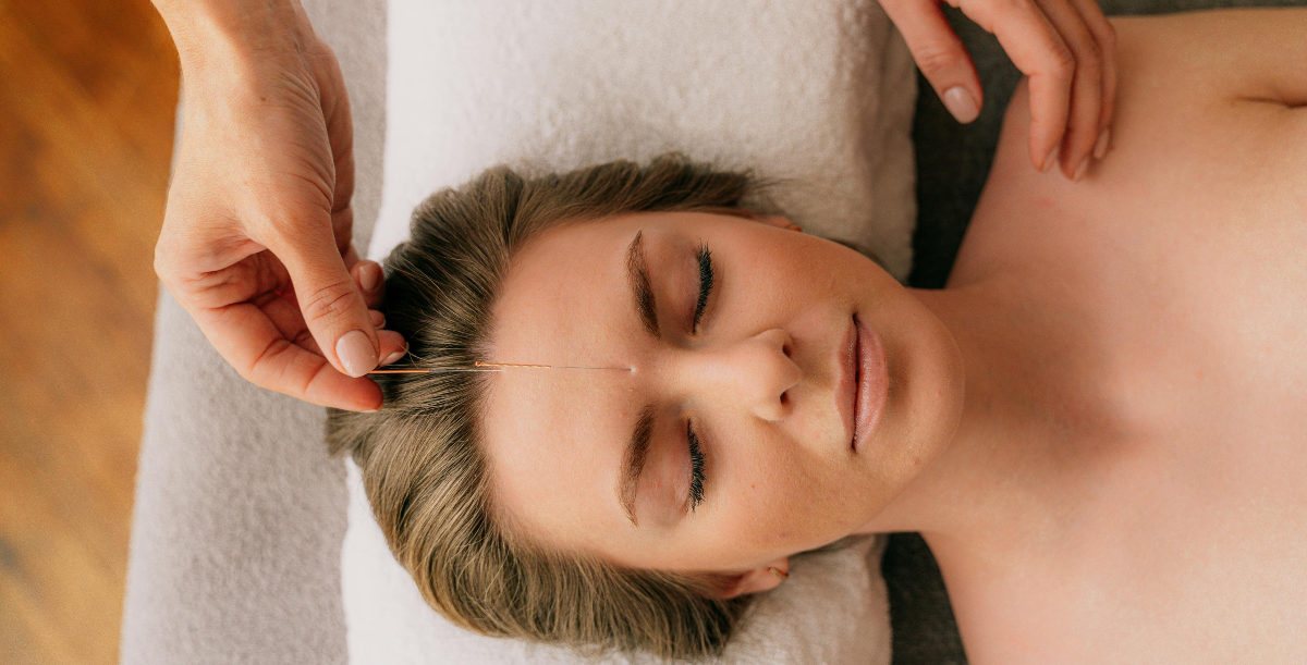 Acupuncture Needle In Ladies Forehead
